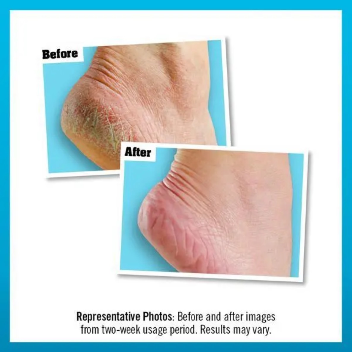 O’Keeffe’s Healthy Feet Foot Cream – Extremely Dry, Cracked Feet – Jar - Image 3